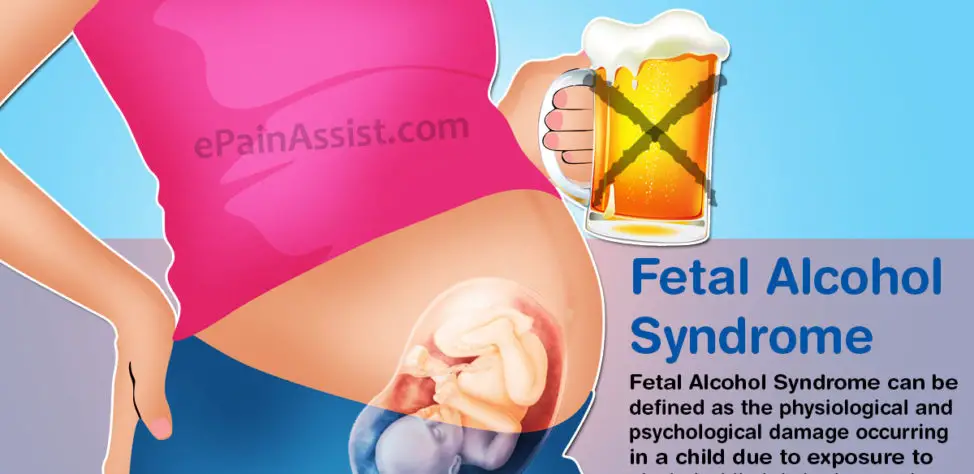 Can You Treat Fetal Alcohol Syndrome
