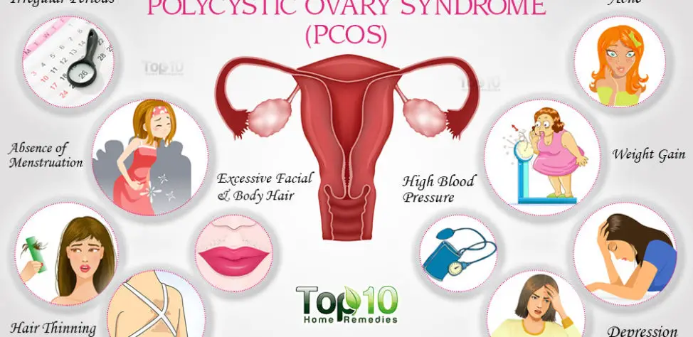What Is PCOS