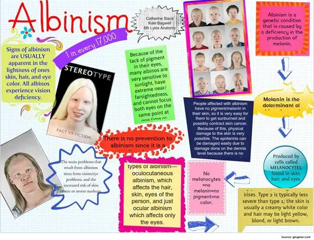 What Is Albinism