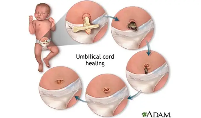 How Long Does The Umbilical Cord Stay On