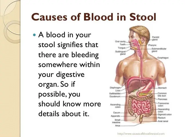 What Causes You To Poop Blood